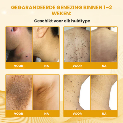 DERMCLYR™ | Antibacteriële Huidherstelgel