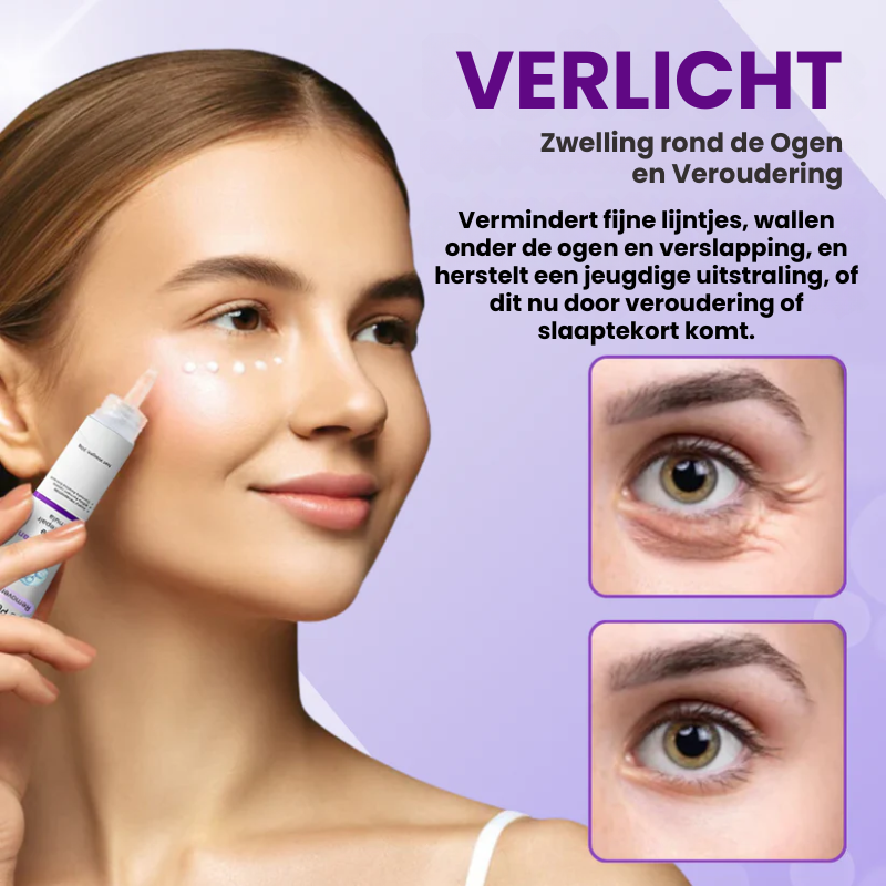 ZERPUFFIN™ | Oogzwelling Crème