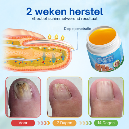 HealthyNail™ | Anti-Schimmel Nagelherstelzalf