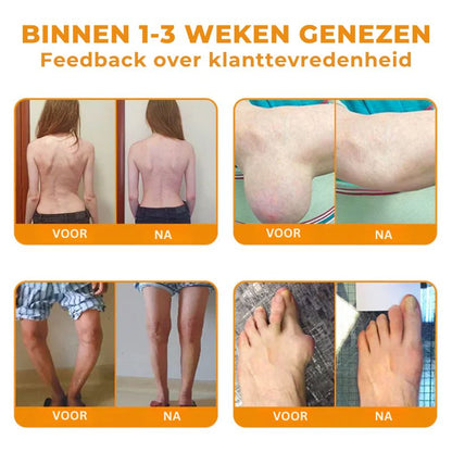 RELIBEEZE™ | Gewrichtshelende Spray