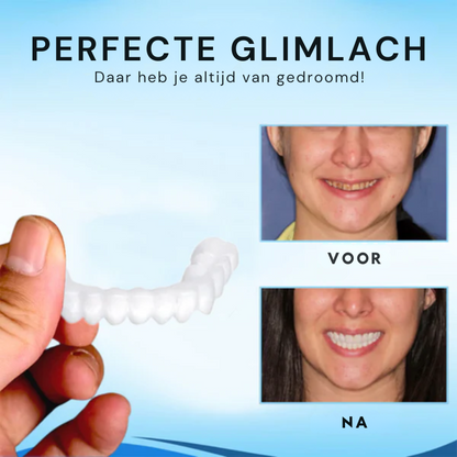 SMILAPTIX™ | Aanpasbaar Klikgebit