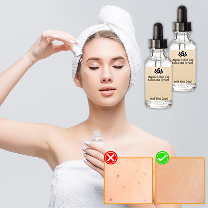 Spotless Skin™ | Biologisch Huidtagoplossingen Serum