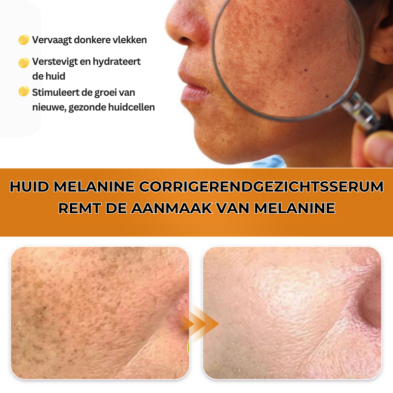 MELAMAZE™ | Melanine Corrigerend Gezichtsserum
