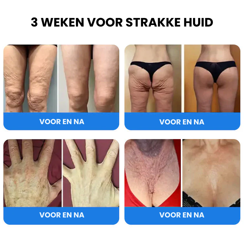 EMUSORA™ | Verstevigende en Anti-rimpel Crème