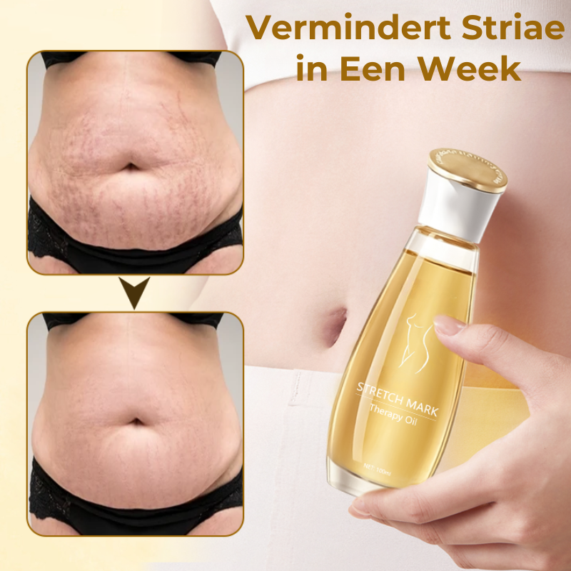 StrioLixir™ | Striaeolie