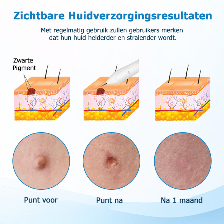 Skin Perfector™ | Huid Perfectie Pen