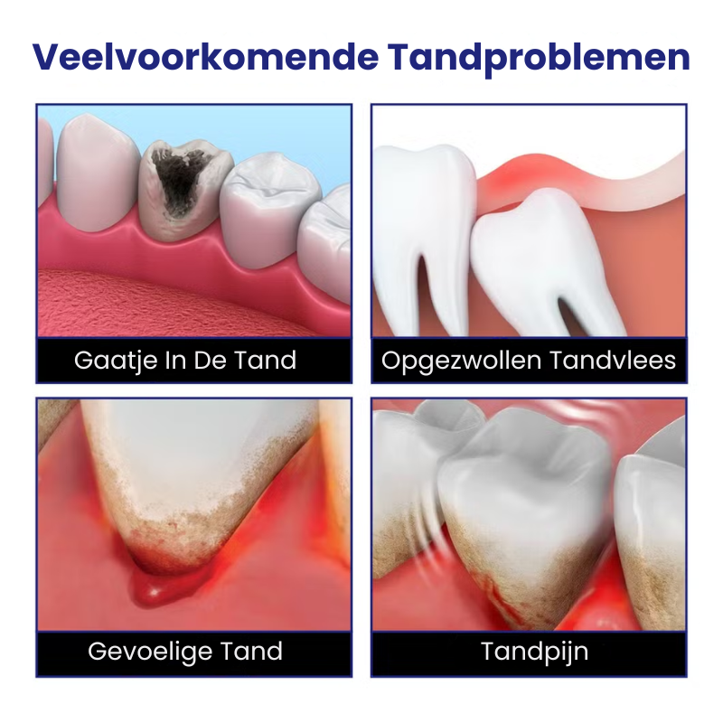 OraZacht™ | Tandpijnspray