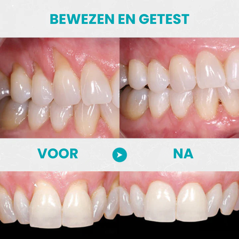 FIXEROOT™ | Tandvleesherstel Behandelampullen