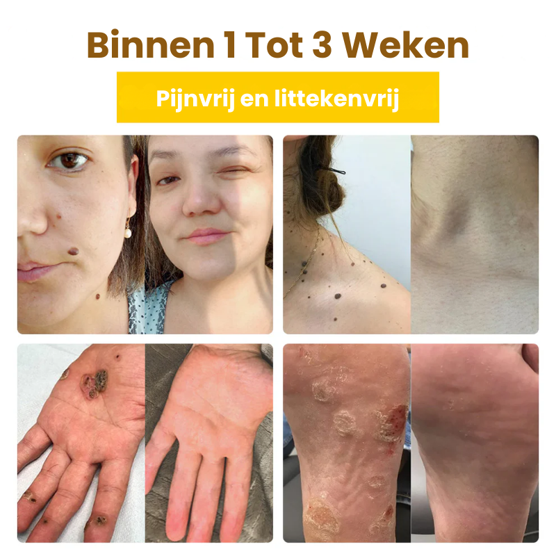 DermaZorg™ | Behandelingscrème