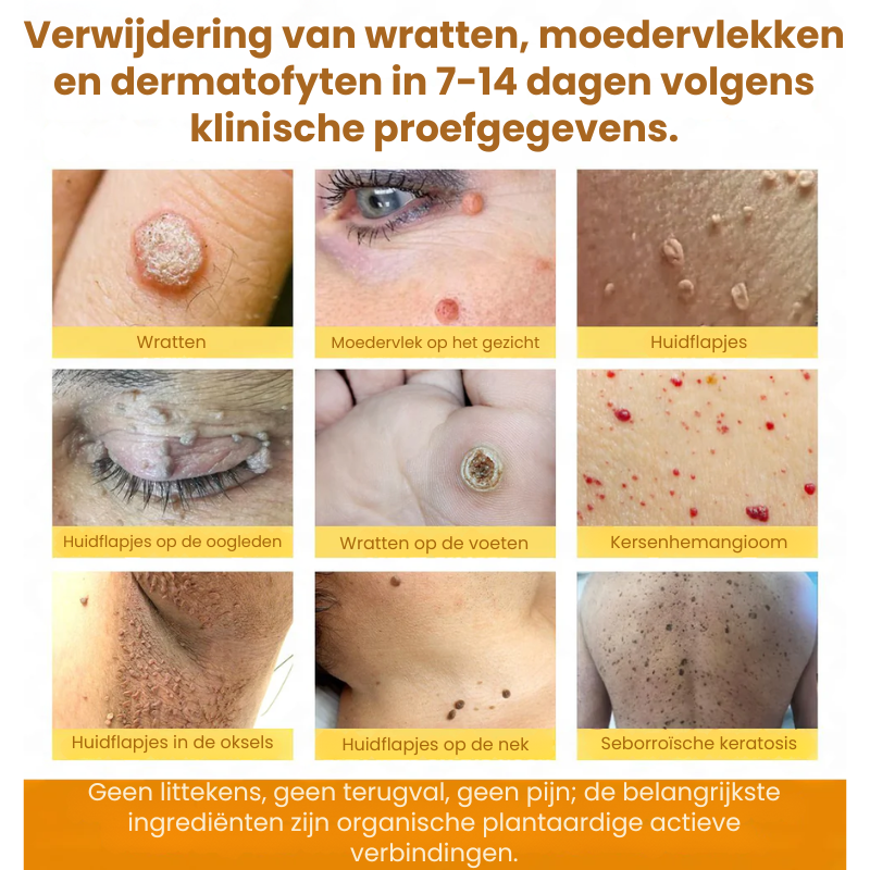 ZestyRenew™ | Huidherstelcrème