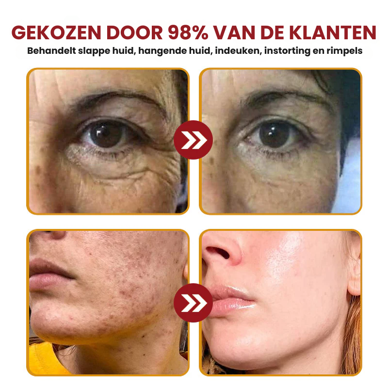 BuzzyGlow™ | Anti-Rimpelserum