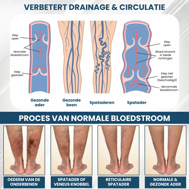 SWERELIEF™ | Zwelling Verlichtende Crème