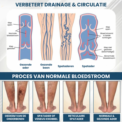 SWERELIEF™ | Zwelling Verlichtende Crème