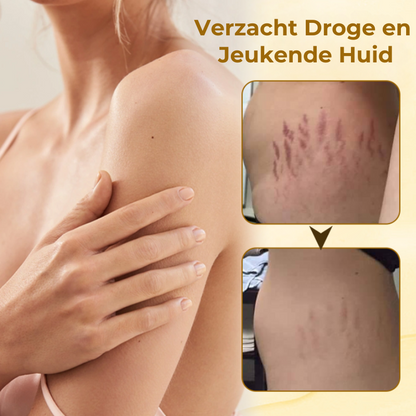 StrioLixir™ | Striaeolie