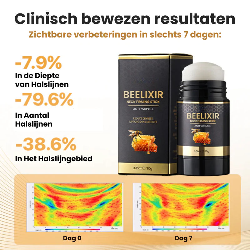 FermiStick™ | Nekverstevigende Stick