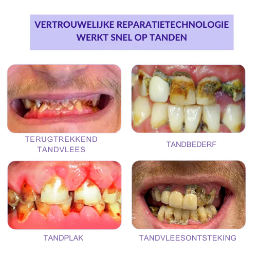ToothBloom™ | Tanden Restauratie Mineraal Poeder