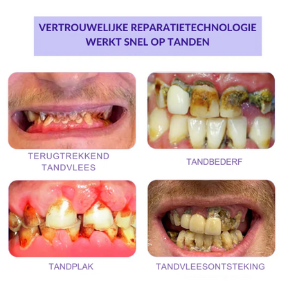 ToothBloom™ | Tanden Restauratie Mineraal Poeder