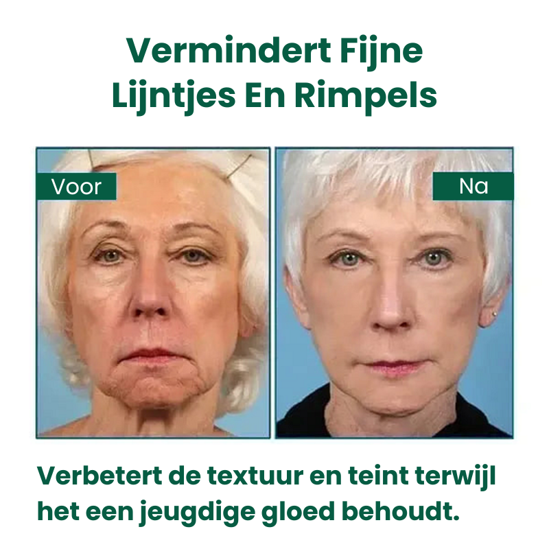 StrakGlow™ | Huidverstevigend Serum