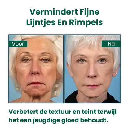 StrakGlow™ | Huidverstevigend Serum