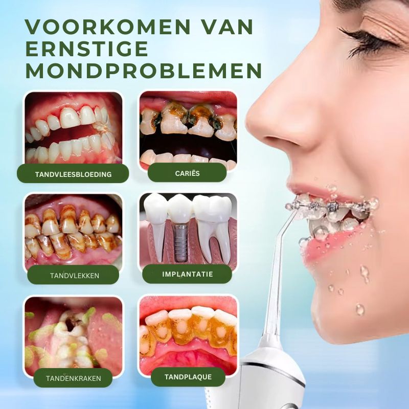 RYNSIQ™ | Tandheelkundige Waterflosser