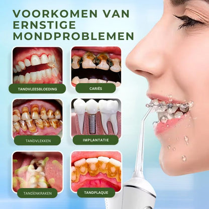 RYNSIQ™ | Tandheelkundige Waterflosser