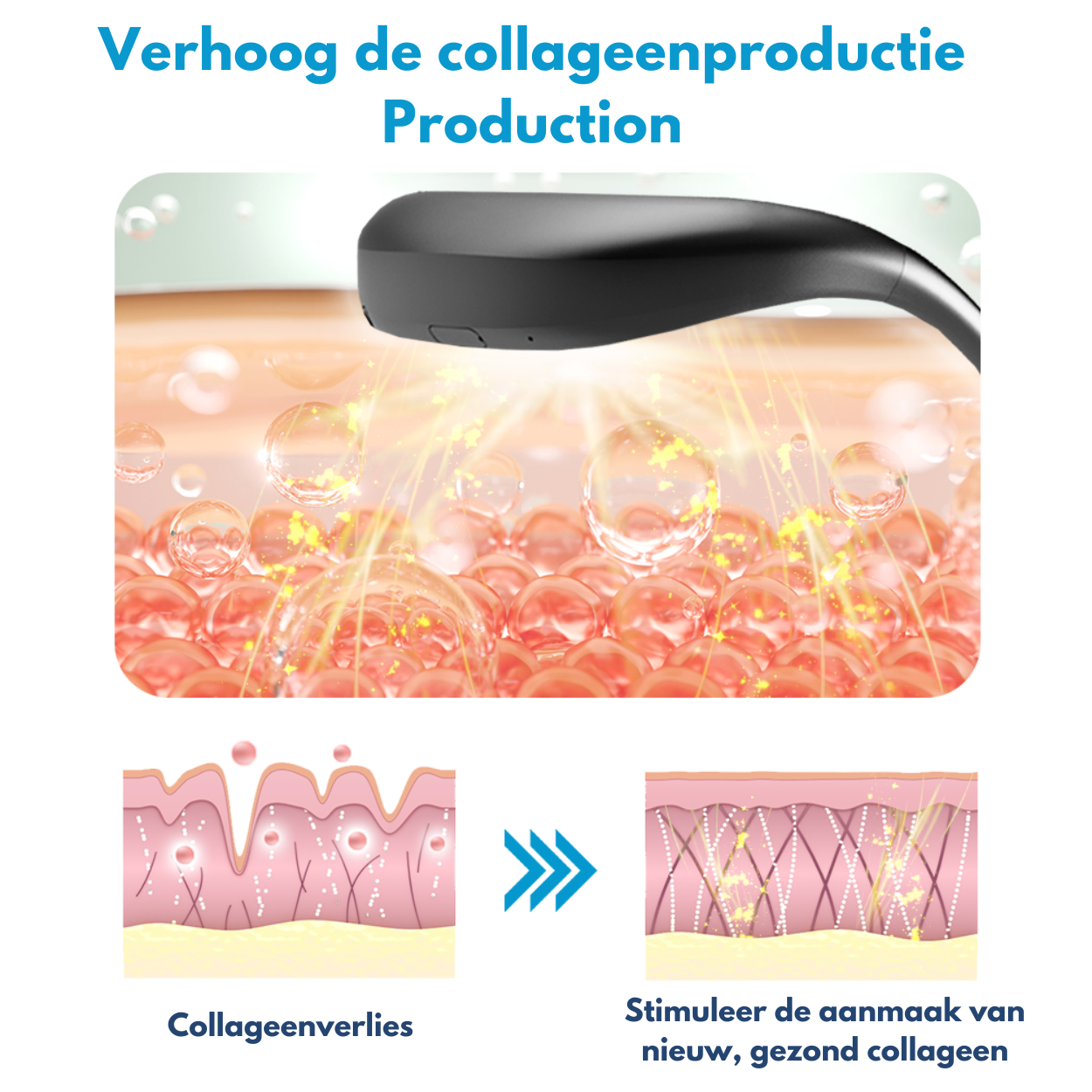 FynFace™ | Kaaklijn Liftend Apparaat