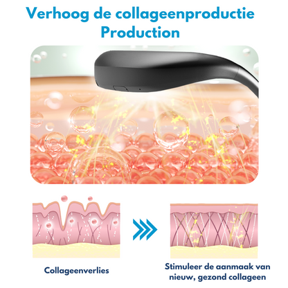 FynFace™ | Kaaklijn Liftend Apparaat