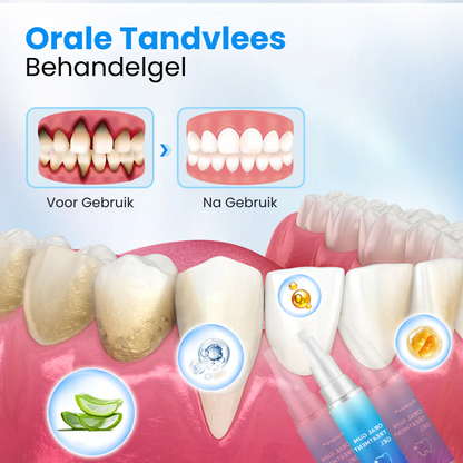 GumKracht™ | Tandvlees Behandelgel
