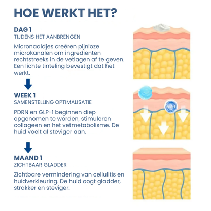 SLYMECT™ | Afslank- & Suikerbalans Serum Reedle Shot