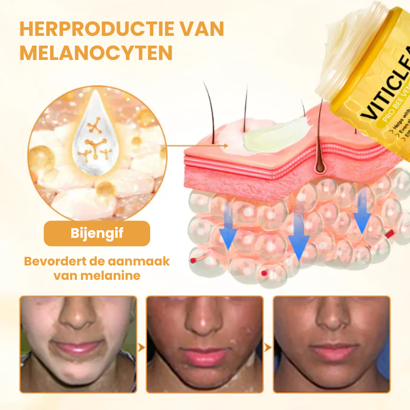 EVYNTONA™ | Huidpigmentatie Crème