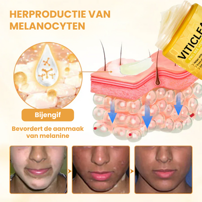 EVYNTONA™ | Huidpigmentatie Crème