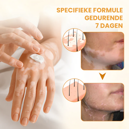 EVYNTONA™ | Huidpigmentatie Crème