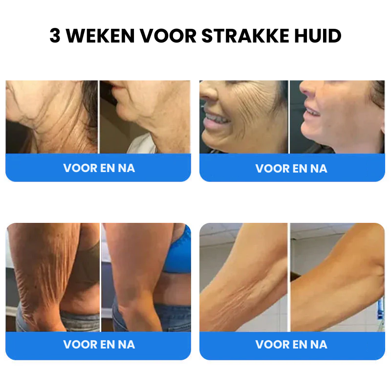 EMUSORA™ | Verstevigende en Anti-rimpel Crème