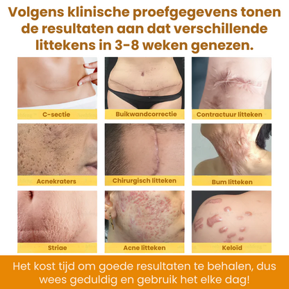 ZestyRenew™ | Huidherstelcrème