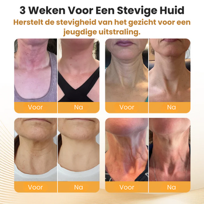 FermiStick™ | Nekverstevigende Stick