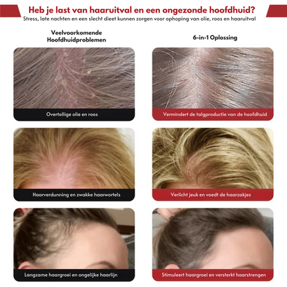 RootSoothe™ | Roodlicht Therapie Borstel + Gratis Haargroei Olie