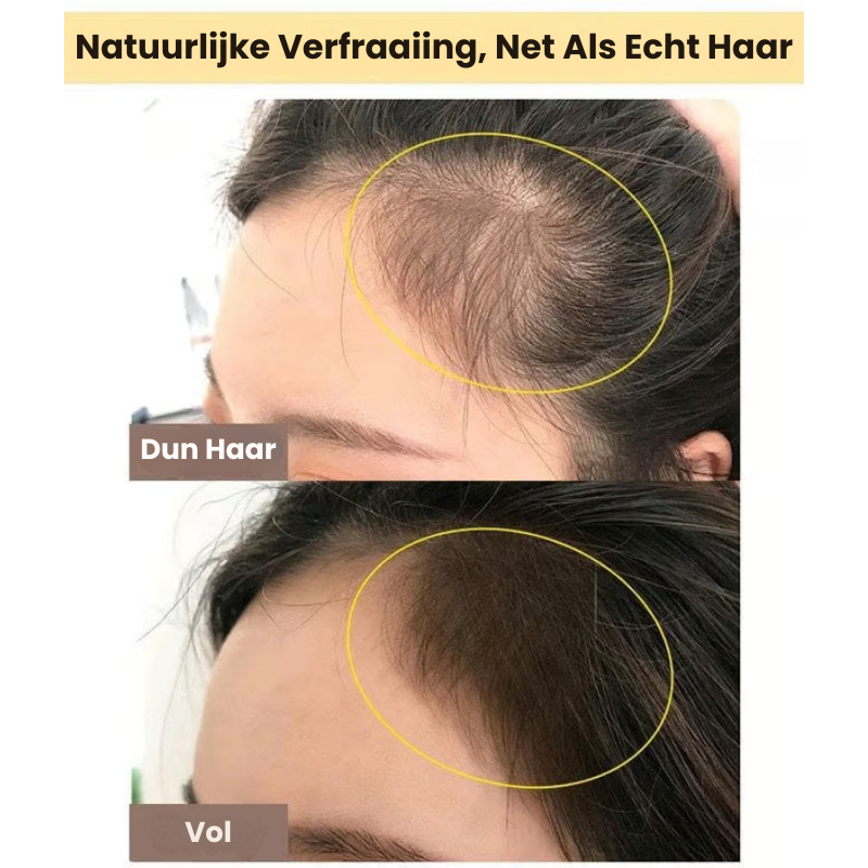 ShedGlow™ | Haarschaduw Sponspen