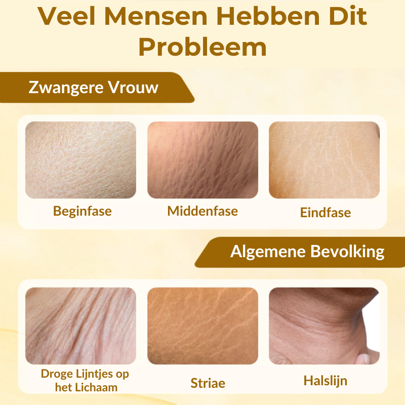 StrioLixir™ | Striaeolie