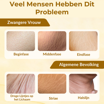 StrioLixir™ | Striaeolie