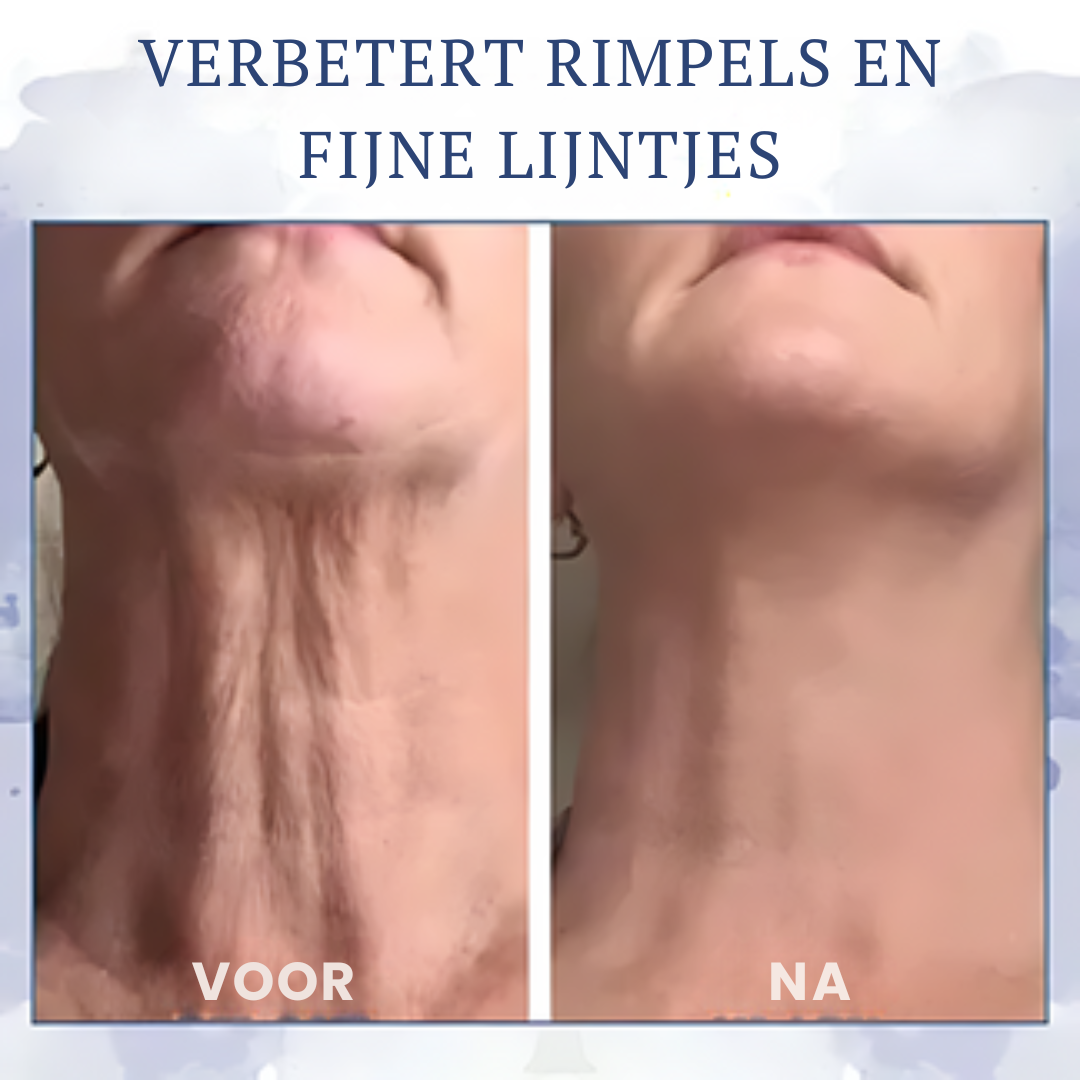 FIRMOZE™ | Verstevigende & Rimpel-verminderende Crème