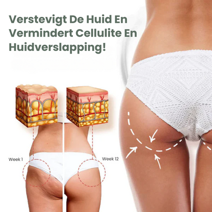 BURNYVA™ | Vetverbrandende Crème