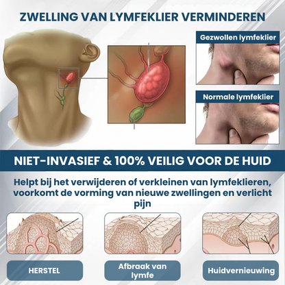 SWERELIEF™ | Zwelling Verlichtende Crème