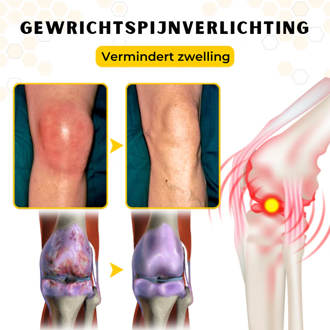 OrthoRestore™ | Gewrichtsverlichtende Crème