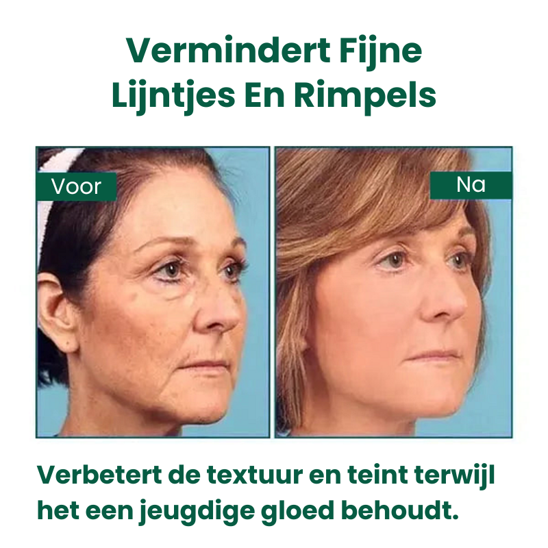 StrakGlow™ | Huidverstevigend Serum