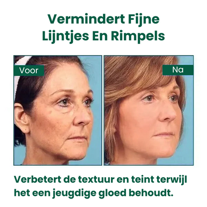 StrakGlow™ | Huidverstevigend Serum