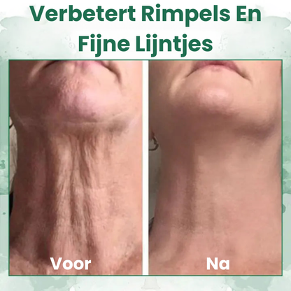 StrakGlow™ | Huidverstevigend Serum