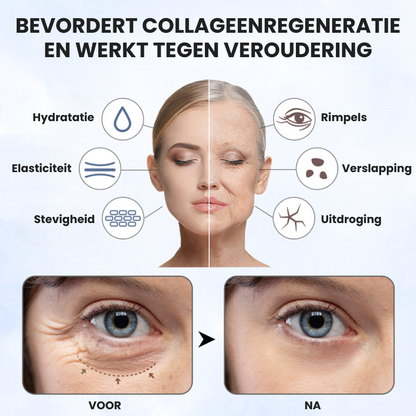 HYAFINA™ | Hyaluronzuur Micronaald Patch