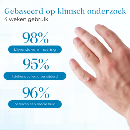 PapiClear™ | Huidtag & Wratten Crème