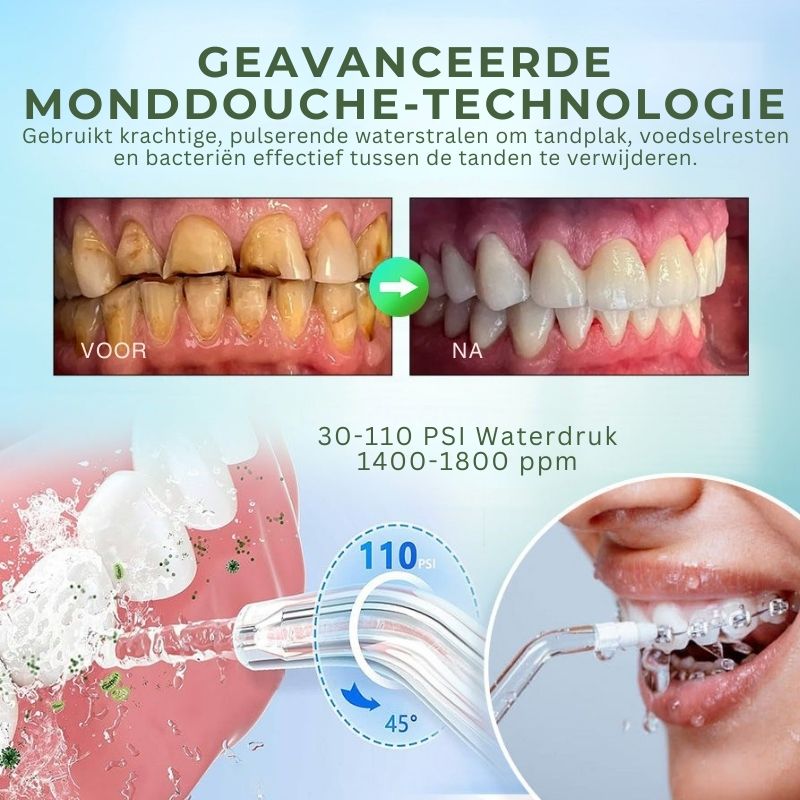 RYNSIQ™ | Tandheelkundige Waterflosser