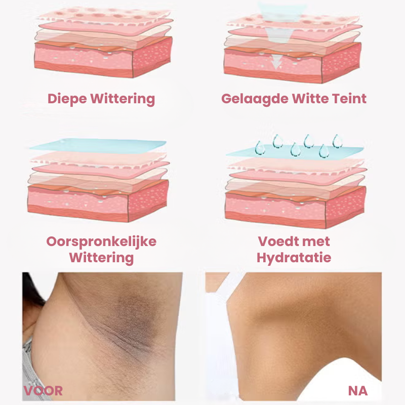 BRIGHTISSE™ | Huidoplichtende Spray